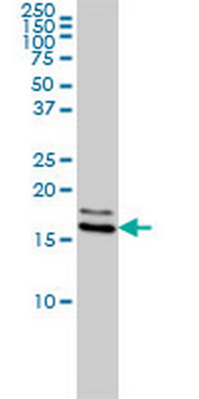 NME1 Antibody in Western Blot (WB)