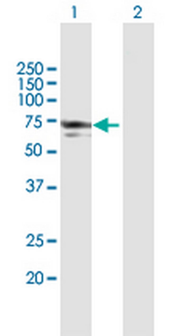 NMT1 Antibody in Western Blot (WB)