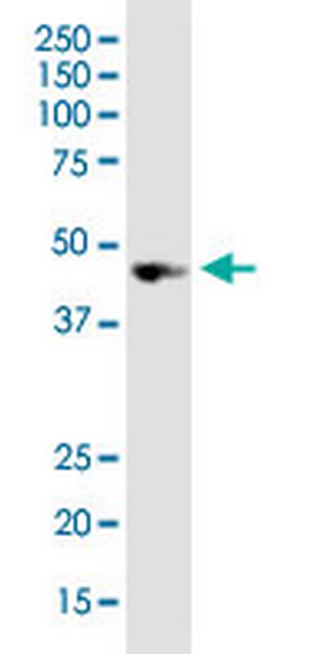 NODAL Antibody in Western Blot (WB)