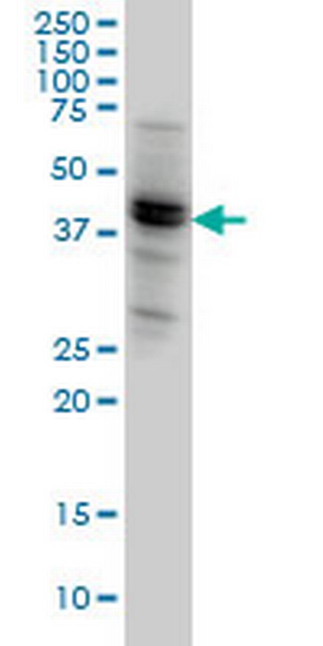 NODAL Antibody in Western Blot (WB)