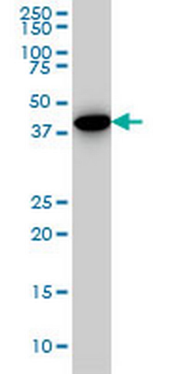 CNOT2 Antibody in Western Blot (WB)