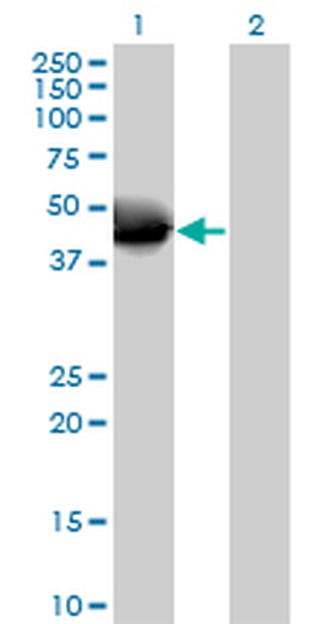 NOV Antibody in Western Blot (WB)