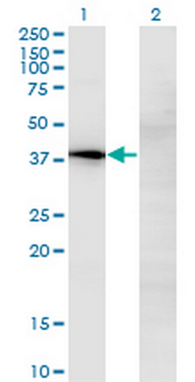 NOV Antibody in Western Blot (WB)