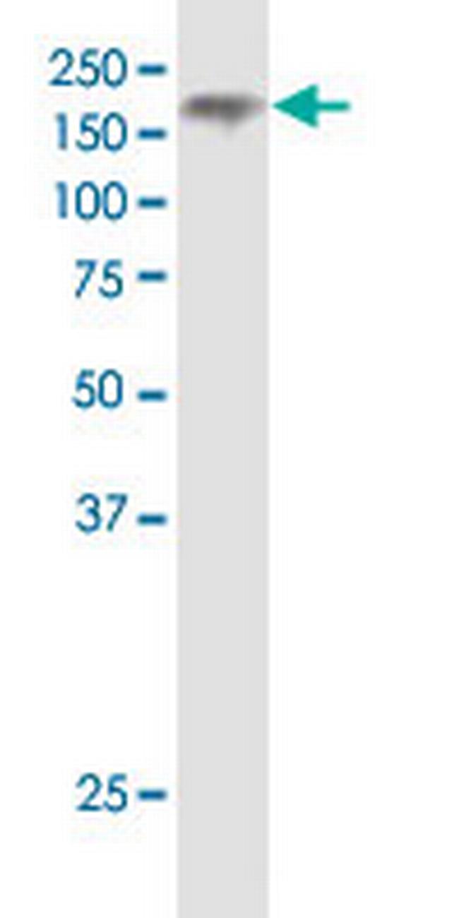 NPC1 Antibody in Western Blot (WB)