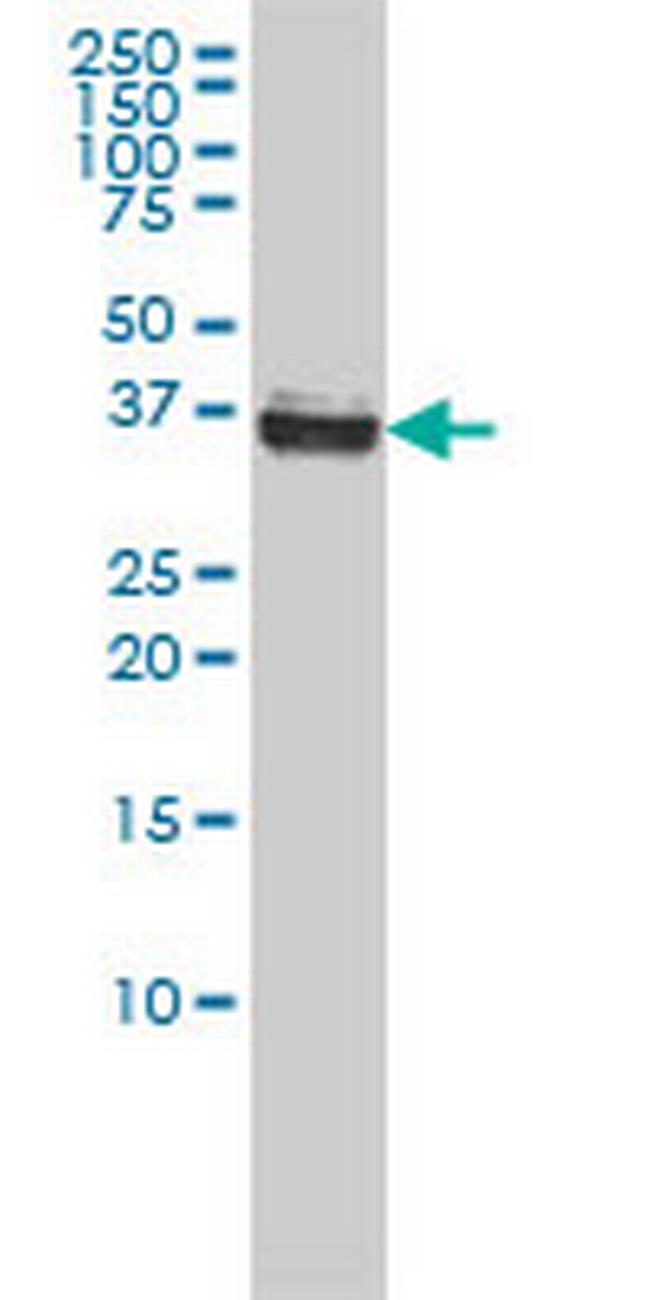 NPM1 Antibody in Western Blot (WB)