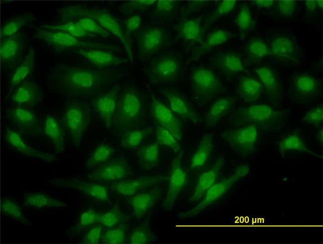 NR4A2 Antibody in Immunocytochemistry (ICC/IF)