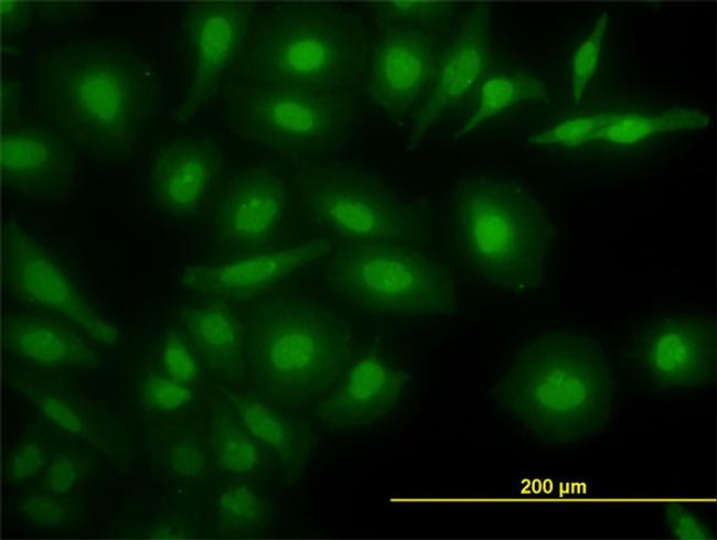 NR4A2 Antibody in Immunocytochemistry (ICC/IF)