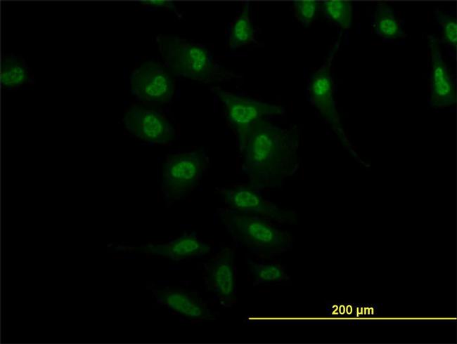 NR4A2 Antibody in Immunocytochemistry (ICC/IF)