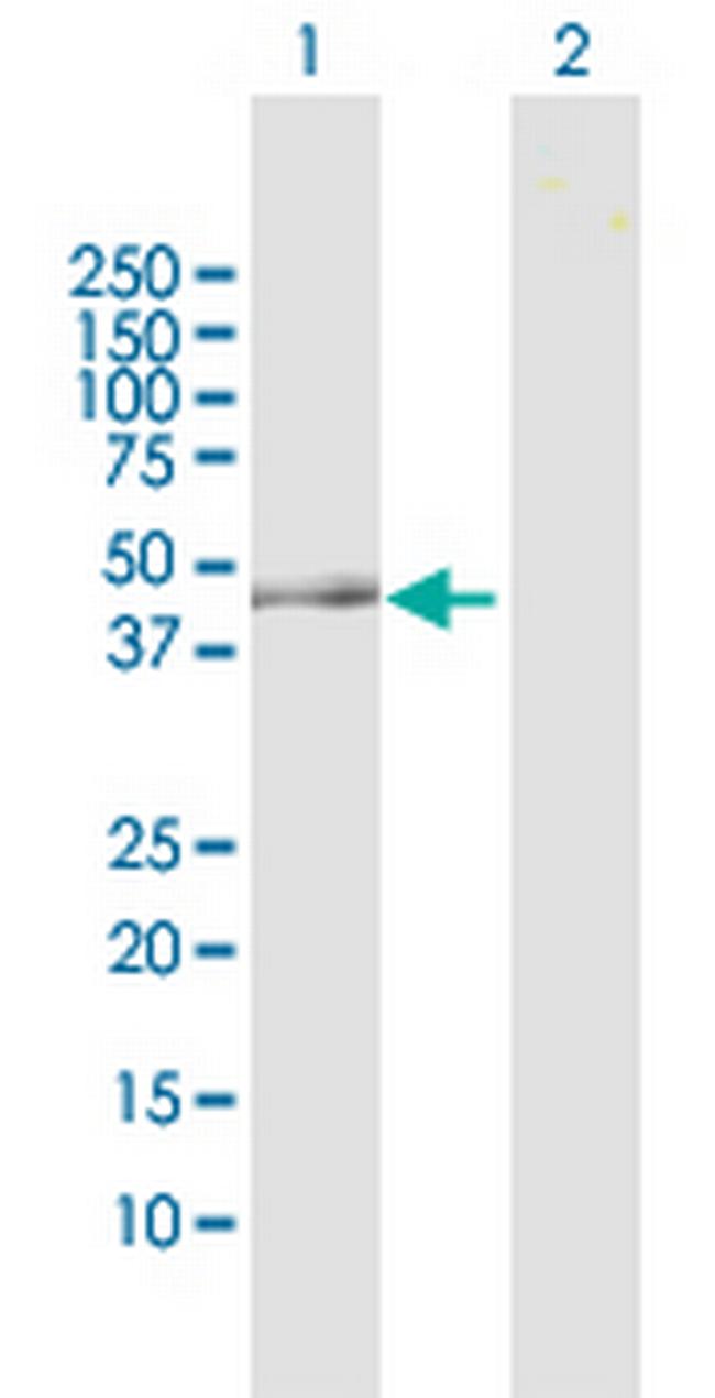 OAT Antibody in Western Blot (WB)