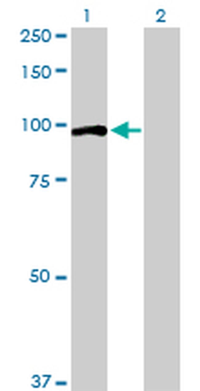 OCRL Antibody in Western Blot (WB)