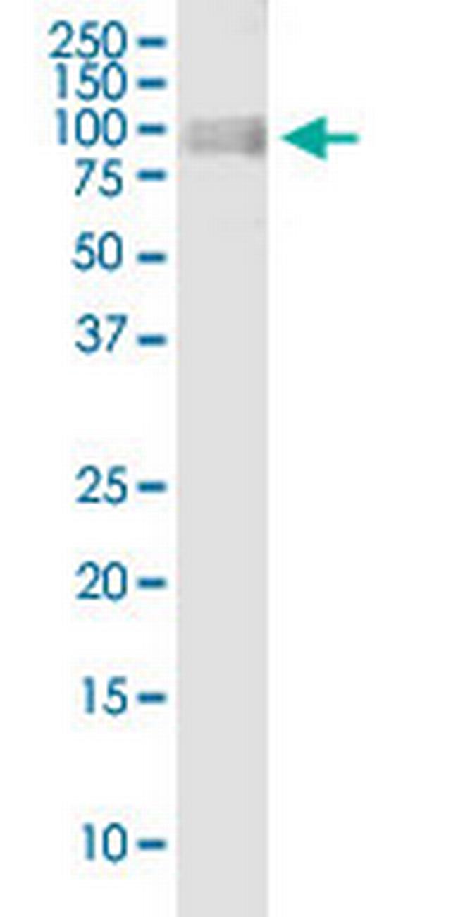 OPA1 Antibody in Western Blot (WB)