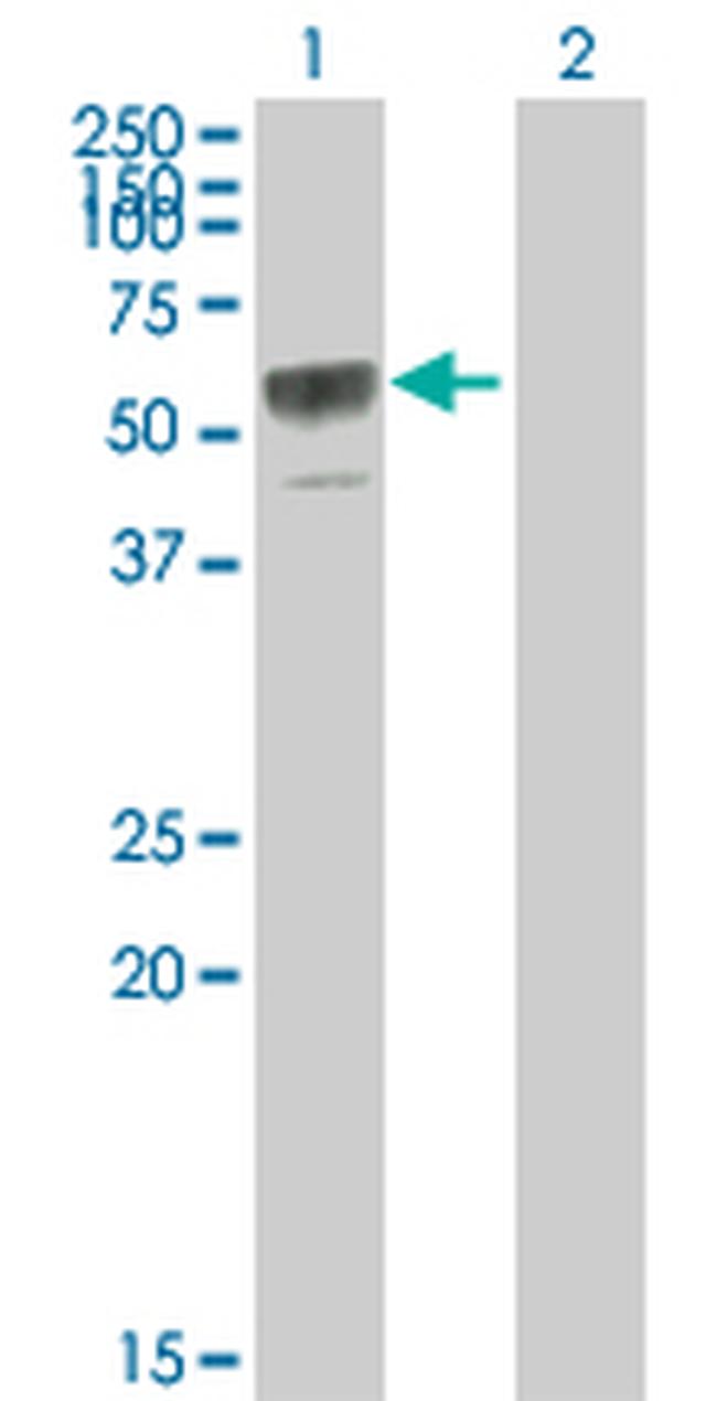 TNFRSF11B Antibody in Western Blot (WB)