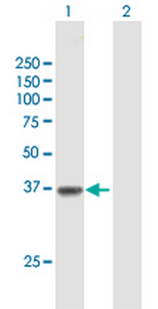 SLC22A18 Antibody in Western Blot (WB)