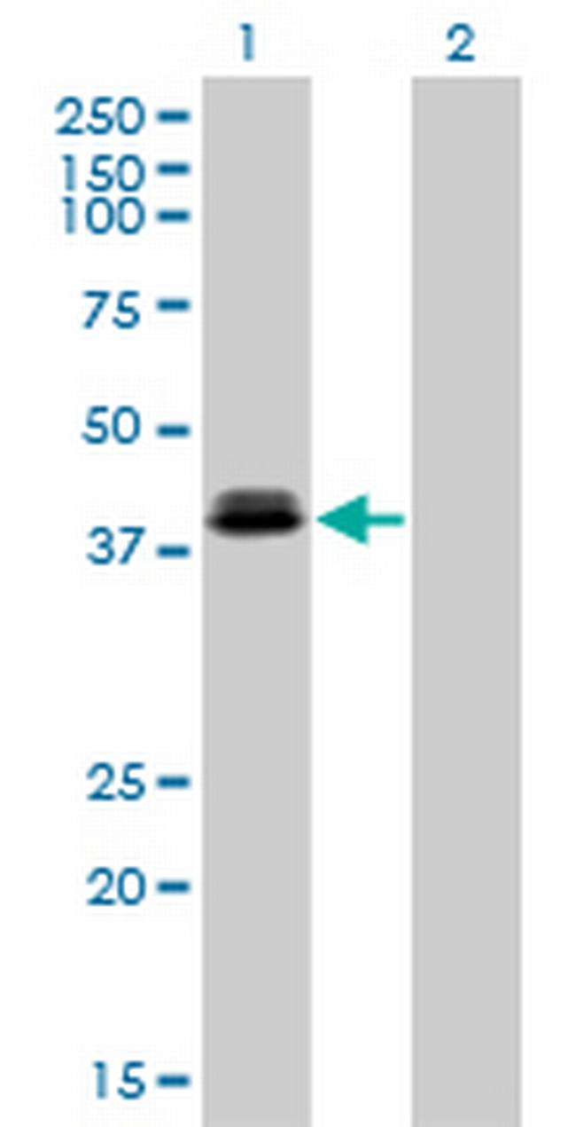 OTX1 Antibody in Western Blot (WB)