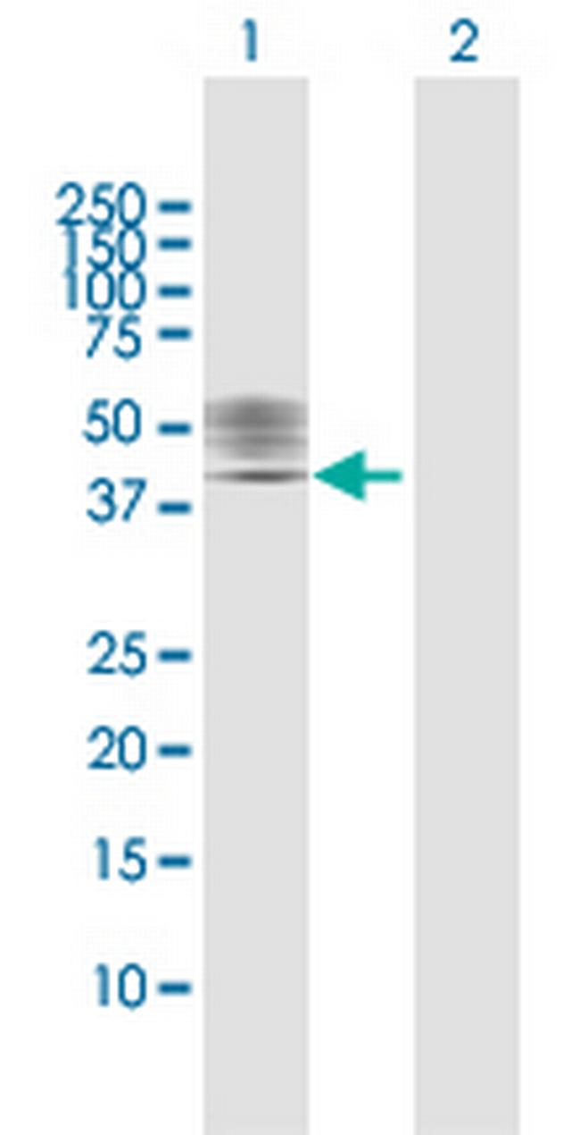 P2RX1 Antibody in Western Blot (WB)