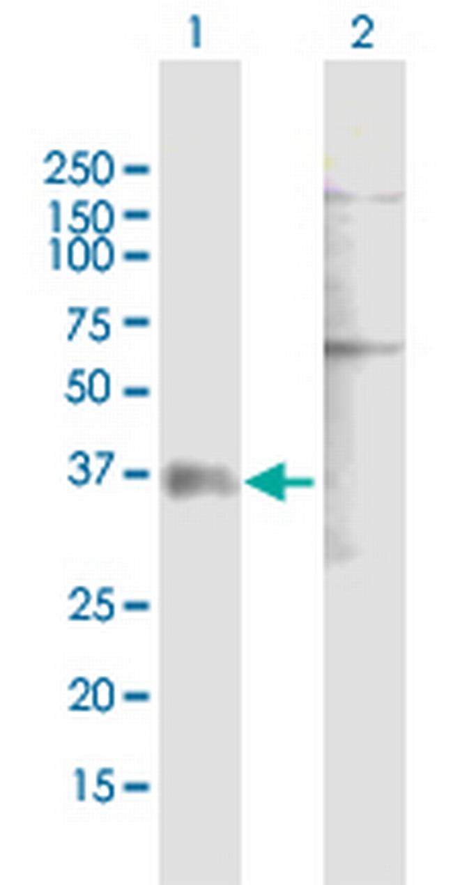 P2RY1 Antibody in Western Blot (WB)