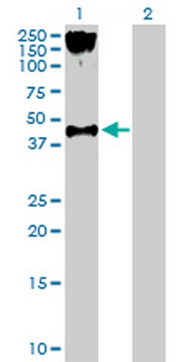 P2RY2 Antibody in Western Blot (WB)