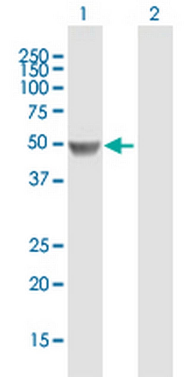 PAH Antibody in Western Blot (WB)