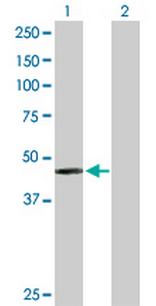 PAH Antibody in Western Blot (WB)