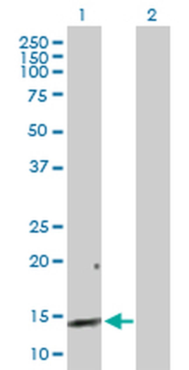 REG3A Antibody in Western Blot (WB)