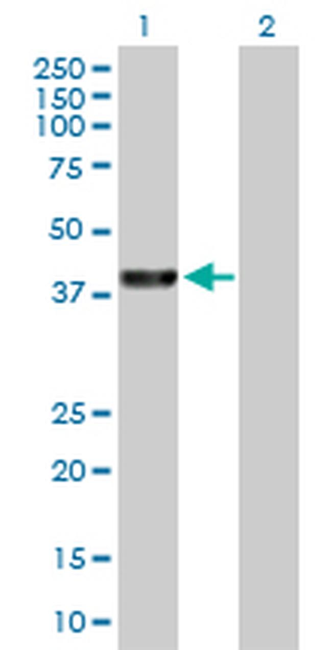 PARK2 Antibody in Western Blot (WB)