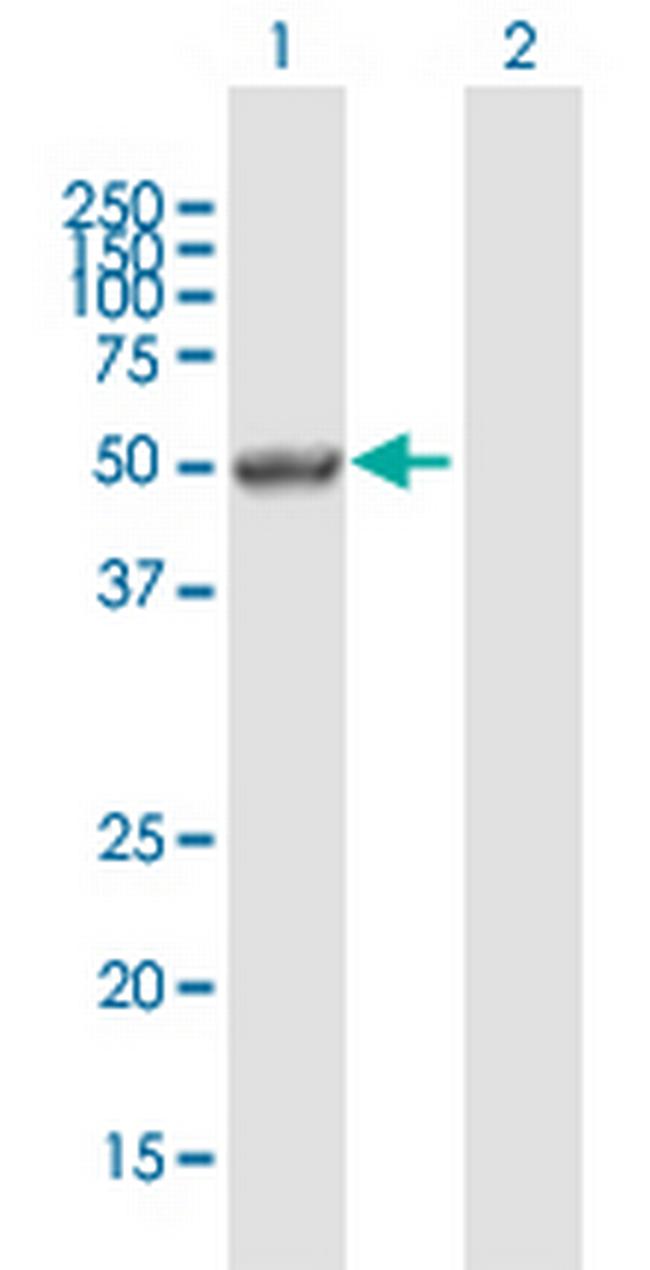 PAX6 Antibody in Western Blot (WB)