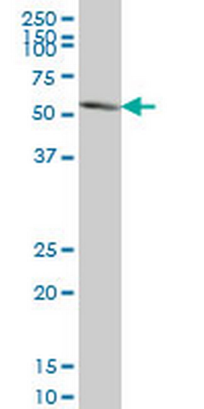 PAX7 Antibody in Western Blot (WB)