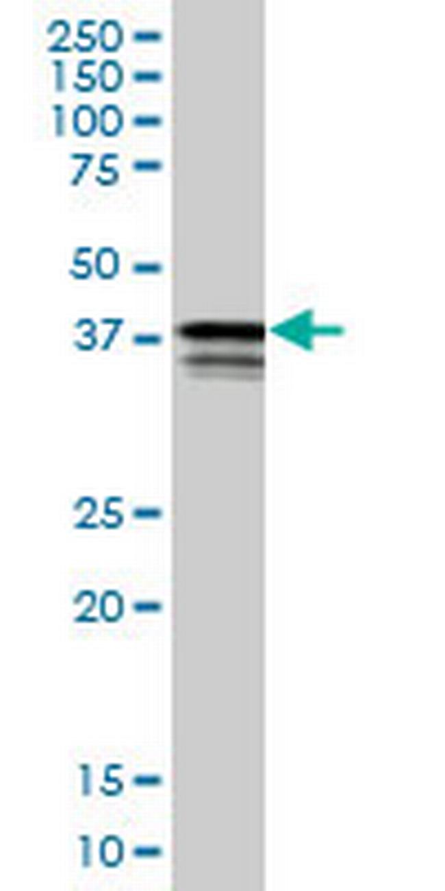 PCBP2 Antibody in Western Blot (WB)