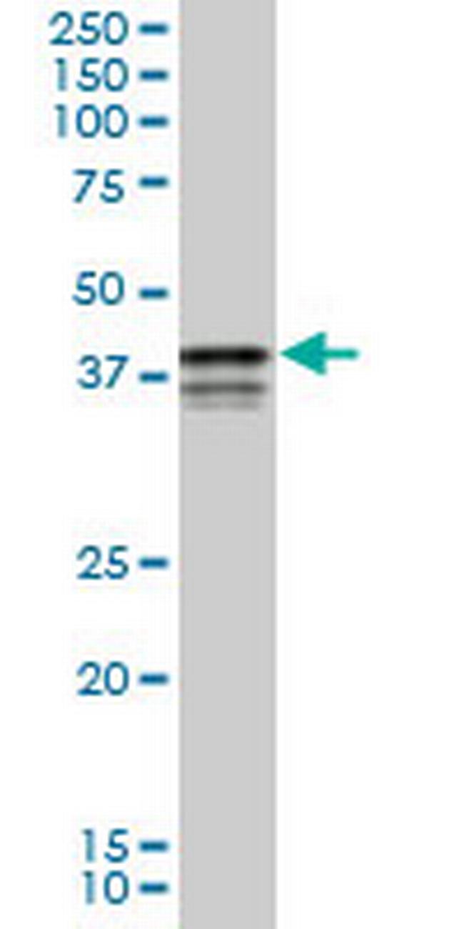 PCBP2 Antibody in Western Blot (WB)