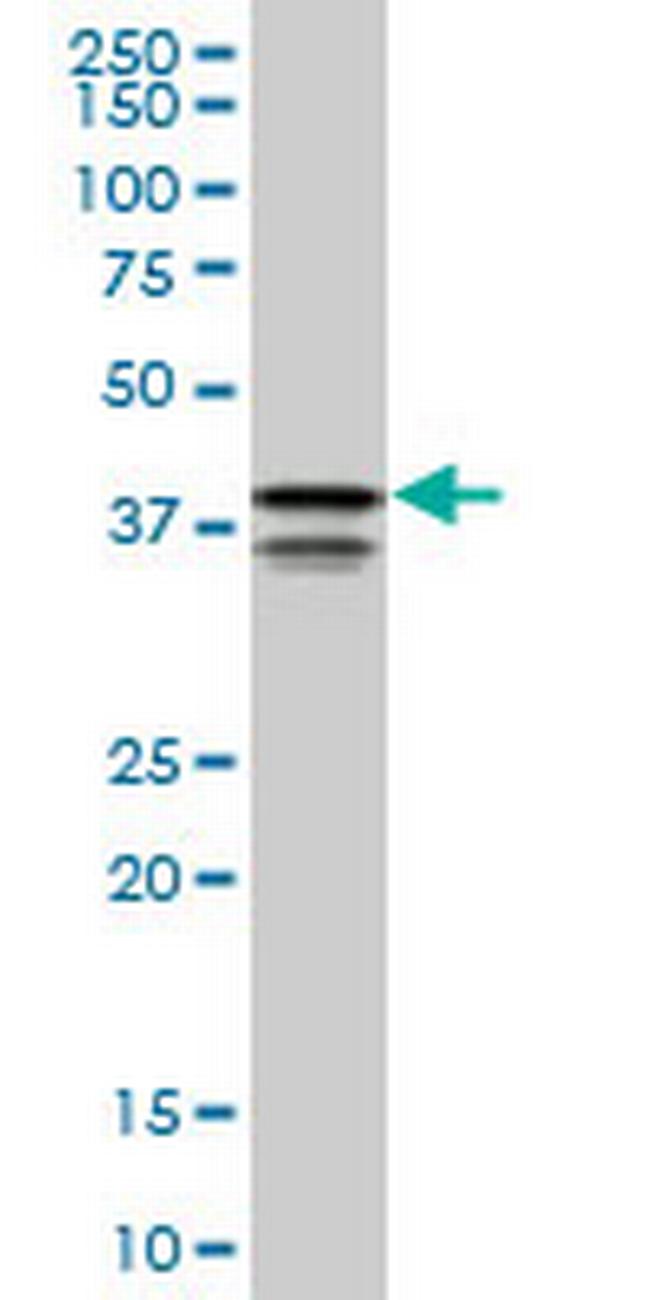 PCBP2 Antibody in Western Blot (WB)