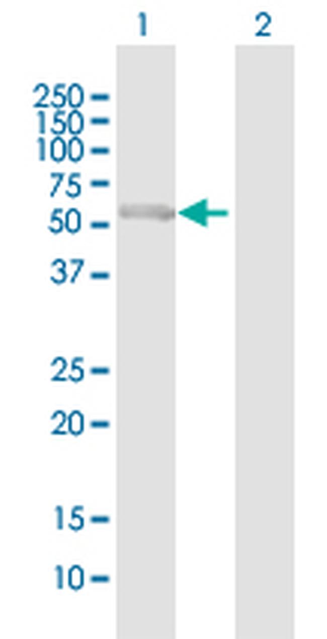 PCCB Antibody in Western Blot (WB)