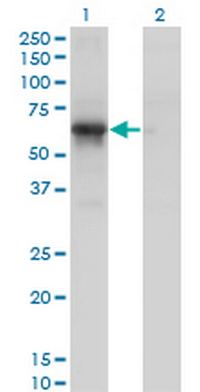 PCTK1 Antibody in Western Blot (WB)