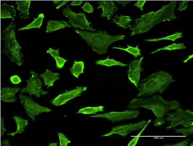 PCTK1 Antibody in Immunocytochemistry (ICC/IF)