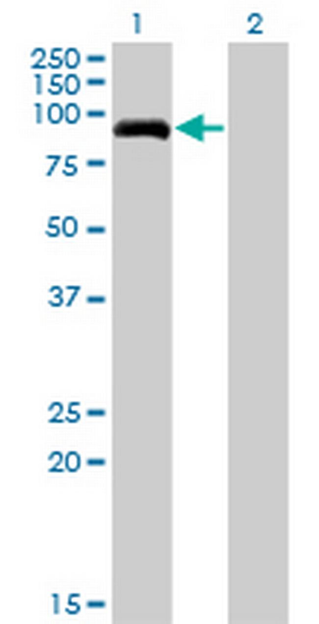 PDE8A Antibody in Western Blot (WB)