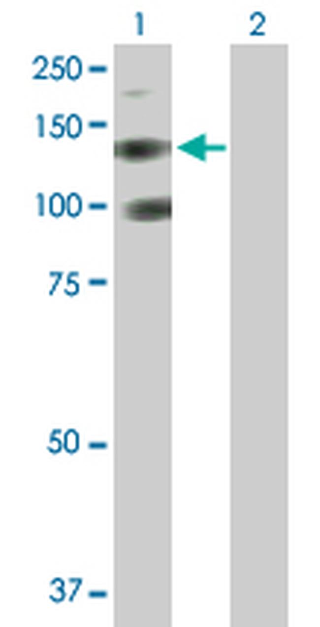 PDGFRA Antibody in Western Blot (WB)