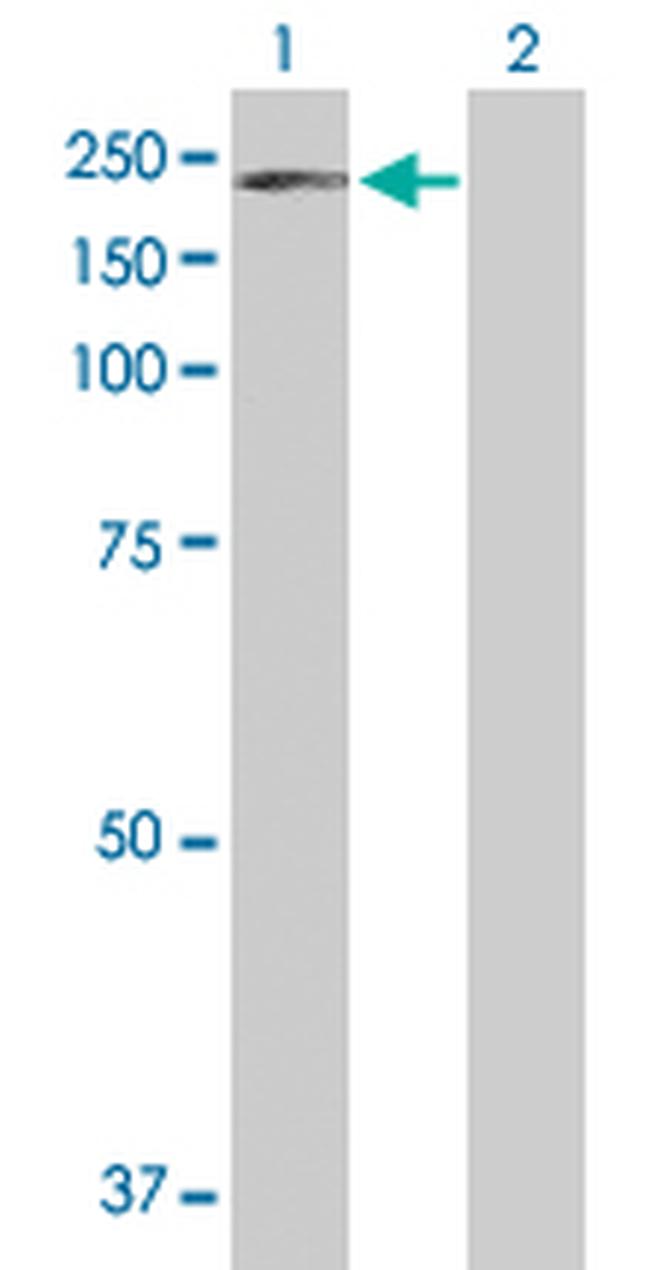 PDGFRB Antibody in Western Blot (WB)