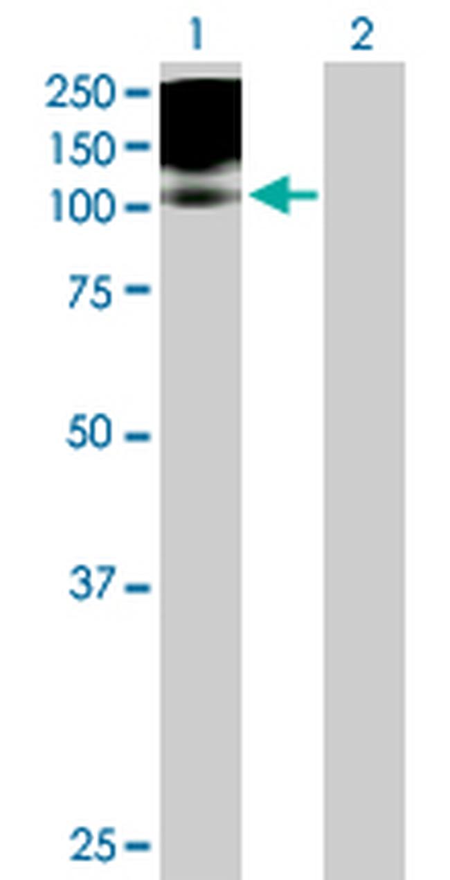 PDGFRB Antibody in Western Blot (WB)