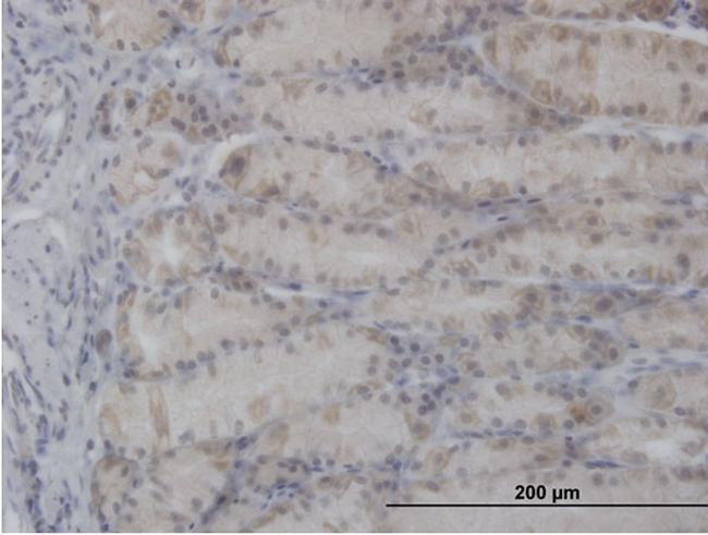 PDHA1 Antibody in Immunohistochemistry (Paraffin) (IHC (P))