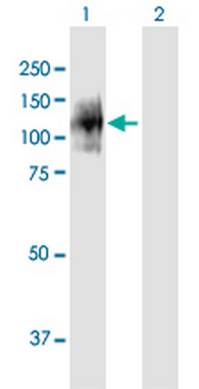 ENPP1 Antibody in Western Blot (WB)