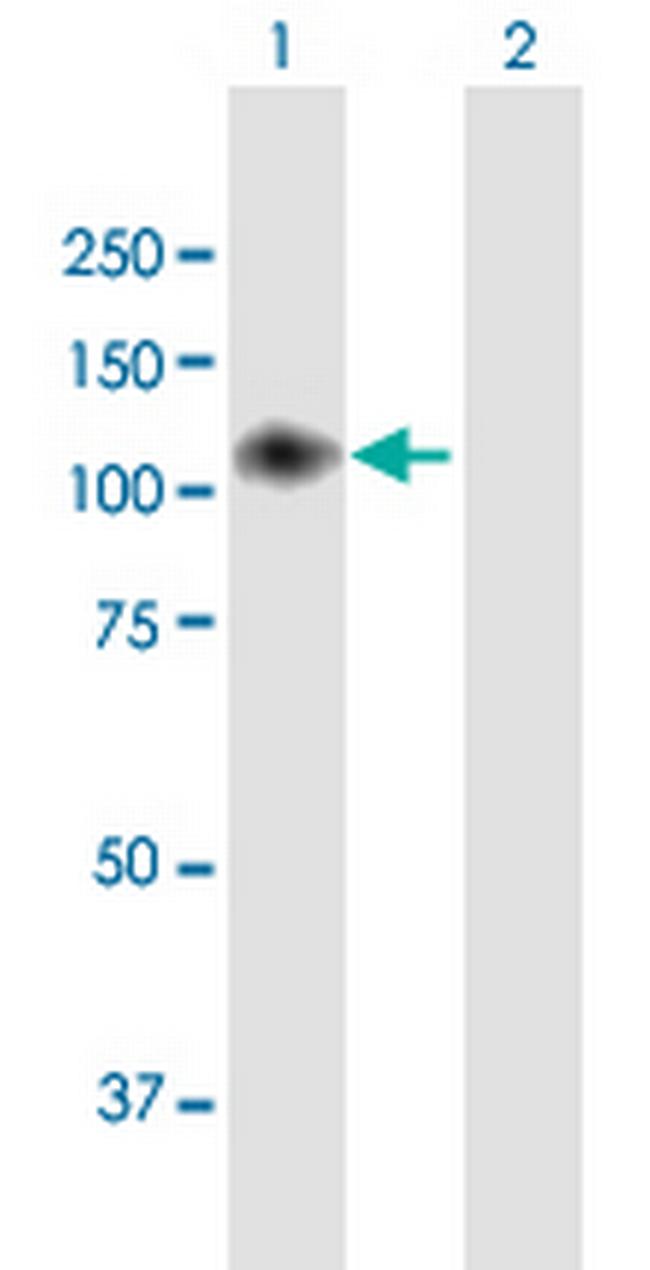 ENPP2 Antibody in Western Blot (WB)