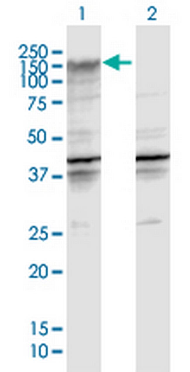 ENPP2 Antibody in Western Blot (WB)