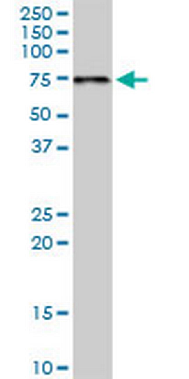 PDZK1 Antibody in Western Blot (WB)