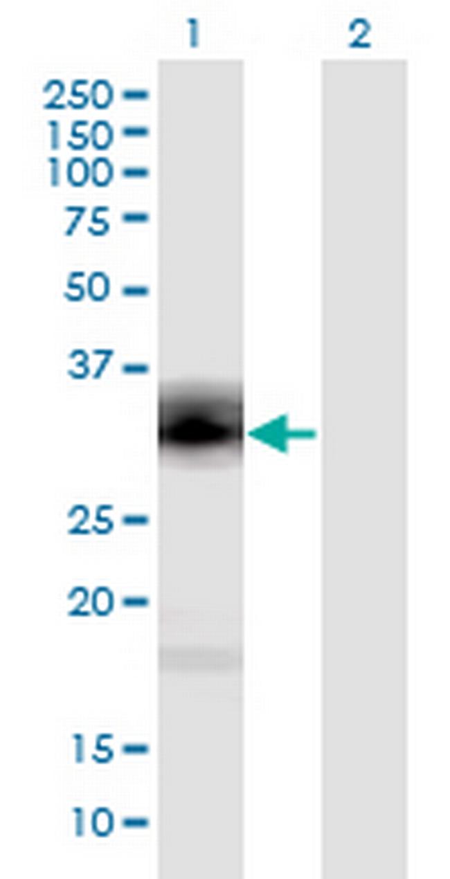 PENK Antibody in Western Blot (WB)