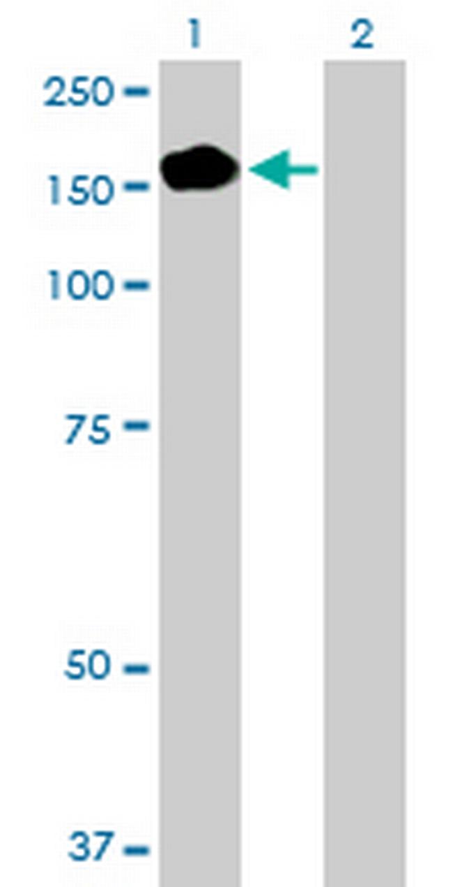 PEX1 Antibody in Western Blot (WB)