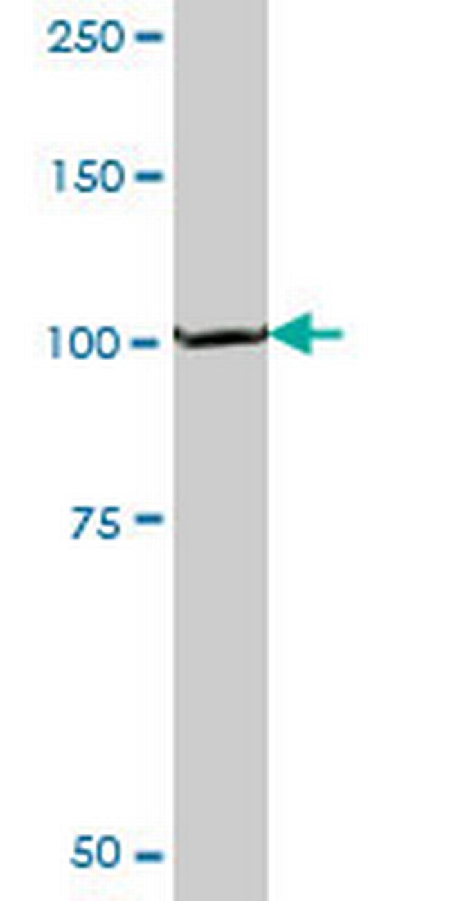 PEX6 Antibody in Western Blot (WB)