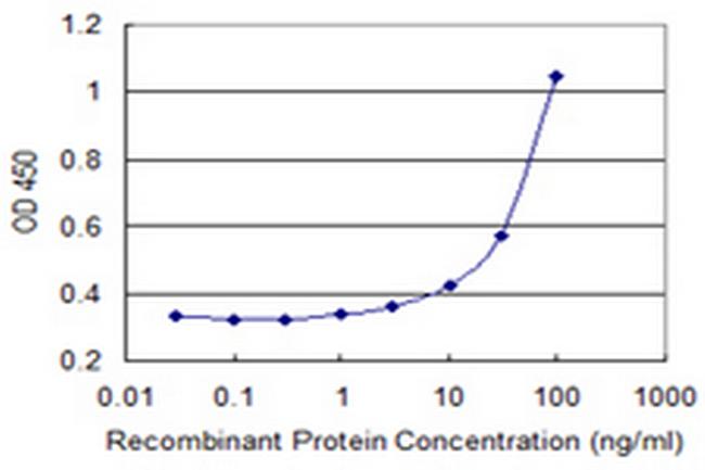 ATP8B1 Antibody in ELISA (ELISA)