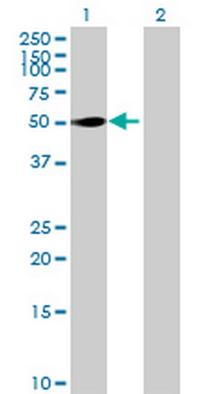 PFKFB1 Antibody in Western Blot (WB)