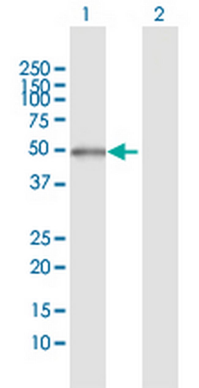 PFKFB1 Antibody in Western Blot (WB)