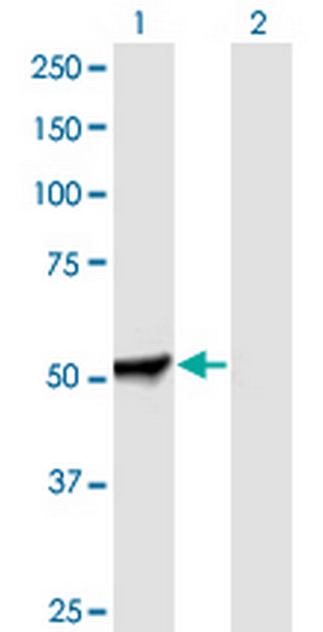 PFKFB2 Antibody in Western Blot (WB)