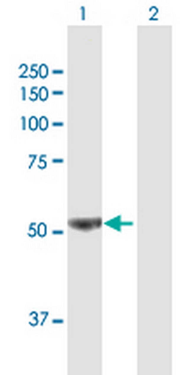 PFKFB3 Antibody in Western Blot (WB)